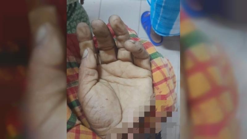 নগরকান্দায় হাতের কব্জি কেটে নেওয়ার ঘটনায় গ্রেফতার ২